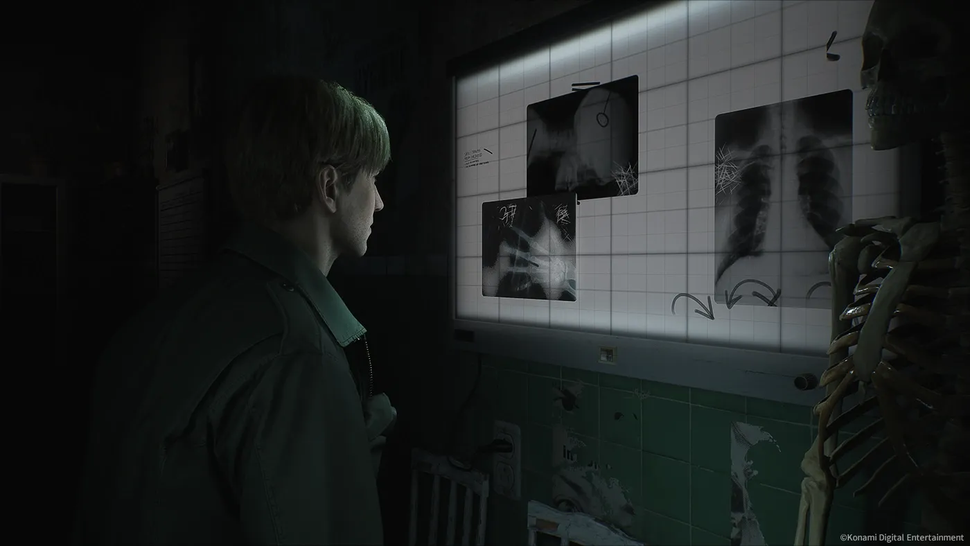 Silent Hill 2 Remake míří na Xbox? Rating naznačuje blížící se vydání!